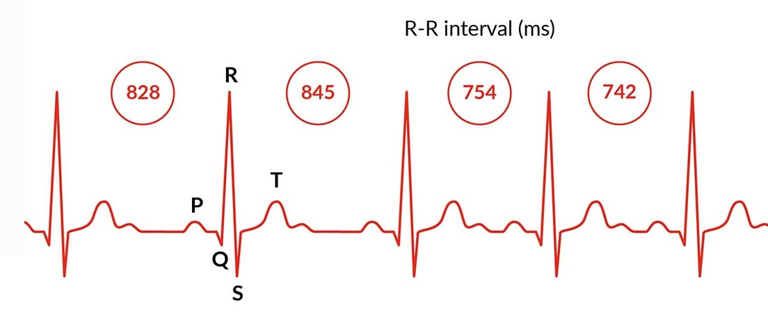 HRV Status